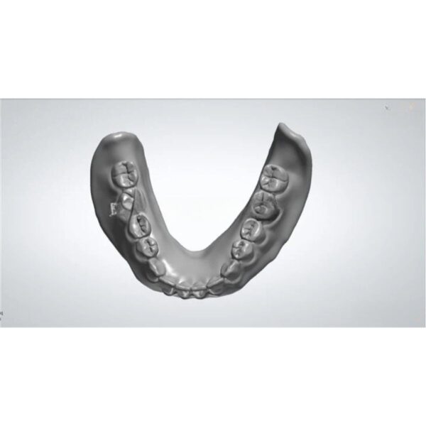 Professional acrylic denture design CAD workflow showing digital modeling process for full denture fabrication